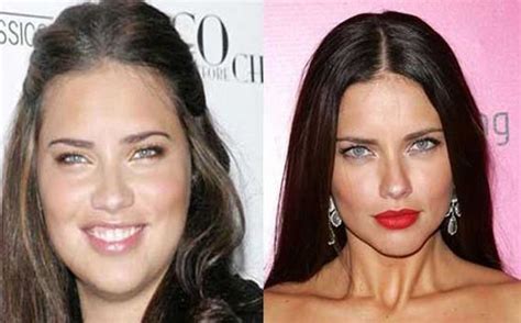 The Truth Behind The Plastic Surgery Of Adriana Lima Lovely Surgery