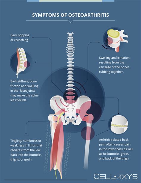 How To Pop Lower Back