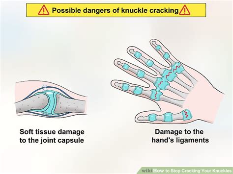 How To Stop Cracking Your Knuckles 13 Steps With Pictures