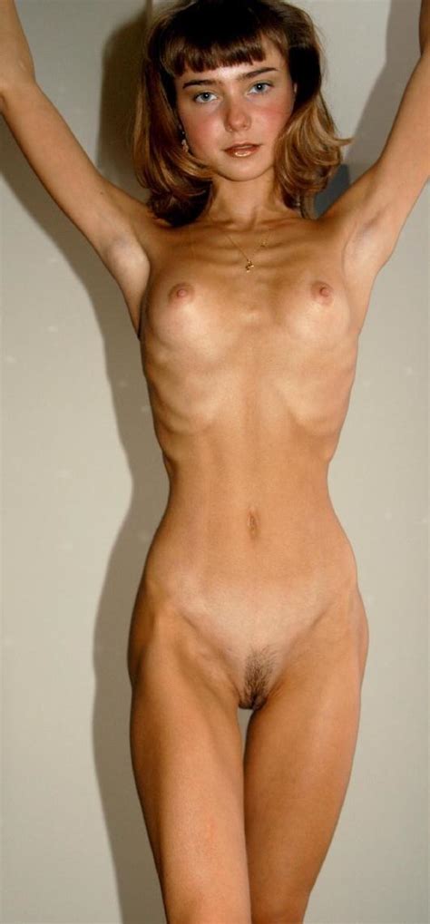 Anorexic Nudes My Xxx Hot Girl