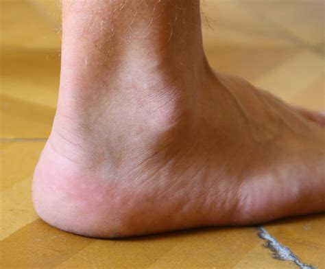 Top 5 Fridays 5 Ankle Patterns Modern Manual Therapy Blog Manual