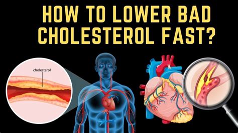 Maybe you would like to learn more about one of these? How to lower bad cholesterol fast in 2020 | Top Foods You ...