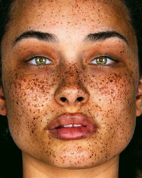 Photographer Captures People With Freckles To Celebrate Their Unique