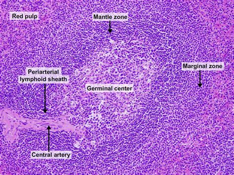 Spleen Disorders Ask Hematologist Understand Hematology