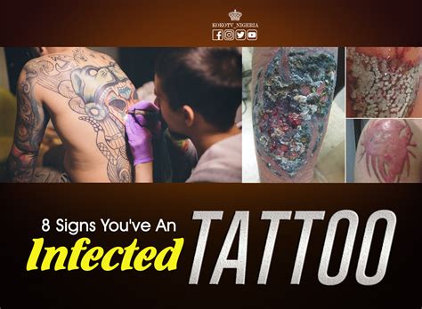 Tattoo aftercare starts as soon as your tattoo is done. You've Got An Infected Tattoo Health: 8 Signs That Tells ...