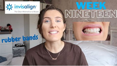 Invisalign Update Rubber Bands And Brackets Week Youtube