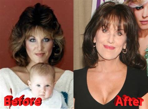 For the famous robin mcgraw who has undergone several procedures, her stories are a hot topic in all media. Robin McGraw Plastic Surgery: Are the new rumors true?