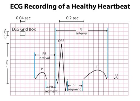 Electrocardiogram Guide Ekgecg Stepwards