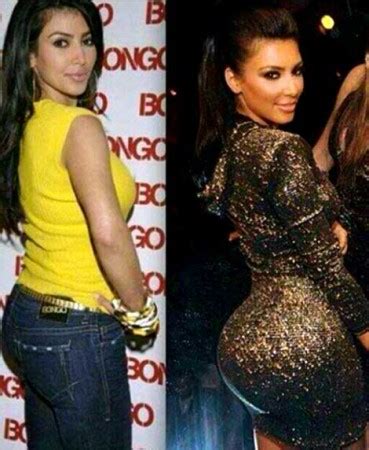 Kim Kardashian Butt Implants Plastic Surgery Before And After Photos