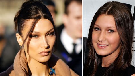 bella hadid admits to plastic surgery and exposes biggest regret 7news
