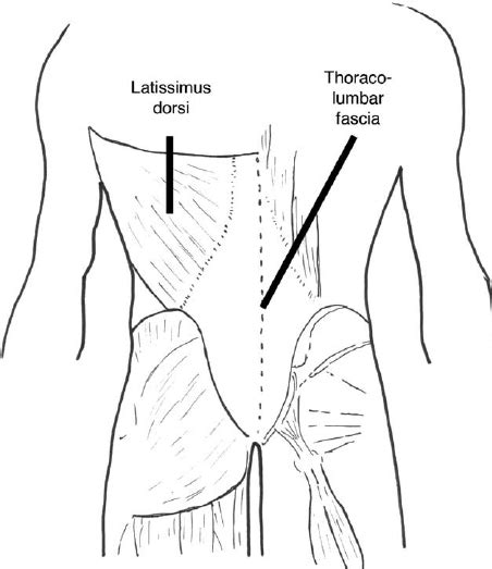The Transversus Abdominus Through Its Attachment To The Lateral Raphe