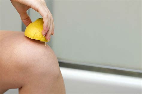 Home Remedy For Dark Knees And Elbows Body Remedy Alternative Medicine