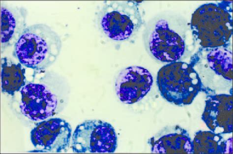 Photograph Of Ascitic Fluid Cells From Tumor Induced Mice Treated With