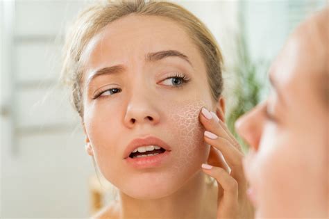 9 Skin Care Routines You Should Follow To Avoid Dry Skin Style Vanity