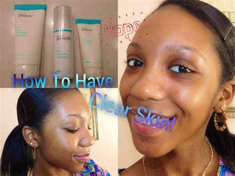 How To Have Clear Skin Does Proactive Work Youtube