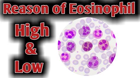Reason Of High Eosinophil High Eosinophil Causes Youtube