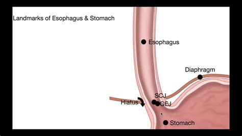 1475 1 Lesson Esophagus Anatomy Youtube