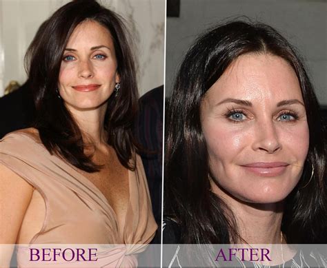 Courtney Cox Plastic Surgery Before And After Botox Cosmetic Procedures