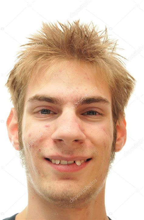 Man Trying Smile Crooked Teeth Isolated White Stock Photo By Vlue
