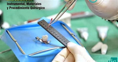 Endodoncia Instrumental Materiales Y Procedimiento Quirúrgico Odonto Tv