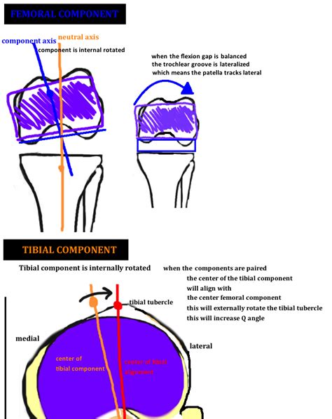 Patellar Tracking — Hip And Knee Book