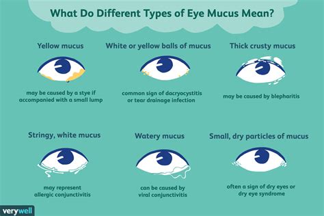 Types Of Eye Mucus Discharge And Boogers Types Of Eye Mucus Pink