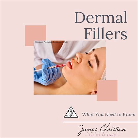 5 Things You Need To Know About Dermal Fillers Dermal Fillers Facial