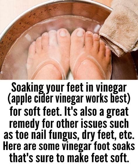 Apple Cider Vinegar For Soft Feet Diy Beautytips