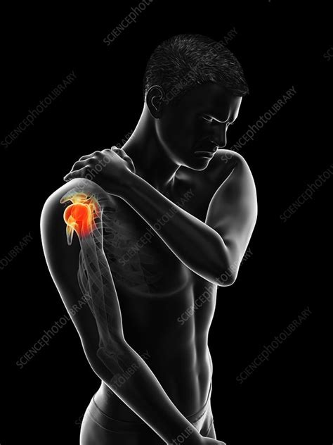 Painful Shoulder Illustration Stock Image F0295387 Science
