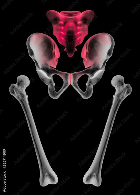 X Ray Of Separate Human Hip And Femur Bone Anterior View Red Highlight