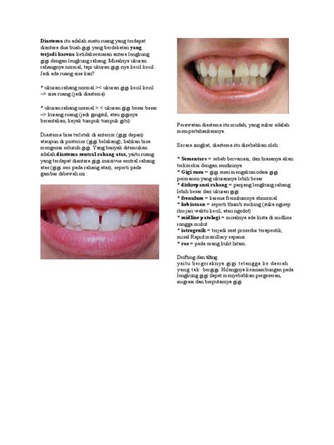 Keeping these points in mind, we can convert the date to local in the following steps: Diastema Itu Adalah Suatu Ruang Yang Terdapat Diantara Dua ...