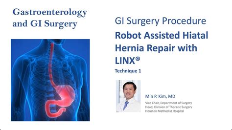 Robot Assisted Hiatal Hernia Repair With Linx Youtube