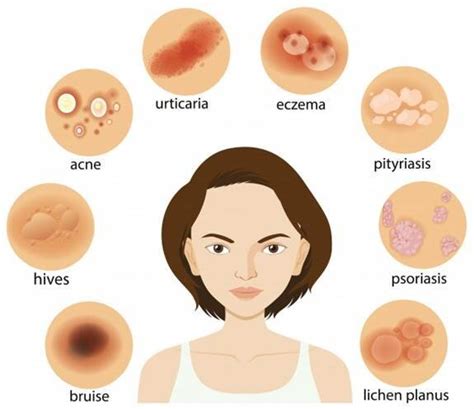 Common Rashes Types Symptoms Treatments And More — Medipulse Best