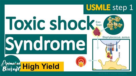 Toxic Shock Syndrome What Causes Toxic Shock Syndrome Signs And