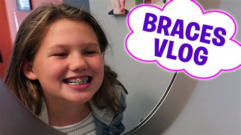 I Got Braces And It Was Super Easy My Braces Vlog Youtube