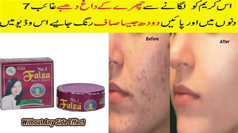 Faiza Beauty Cream Review Usage Benefits Side Effect Skin Whitening Acne Removal Night Cream