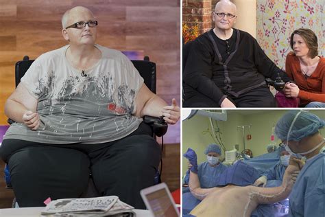 Worlds Fattest Man Begs Nhs For £100k Weight Loss Surgery After Moving