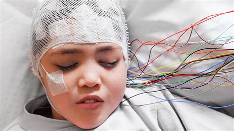 So Erkennen Sie Epilepsie Bei Kindern Ksb Blog