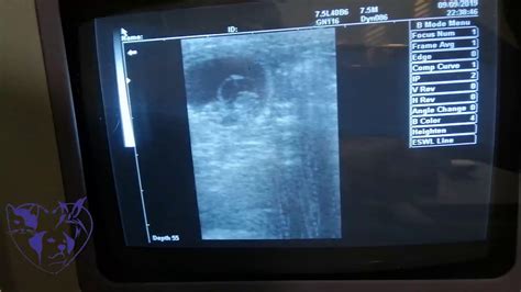 Pregnant Cat Ultrasound Youtube