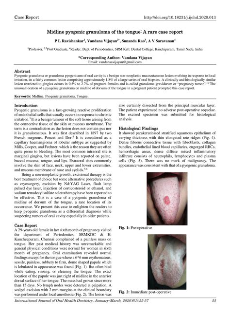Pdf Midline Pyogenic Granuloma Of The Tongue A Rare Case Report