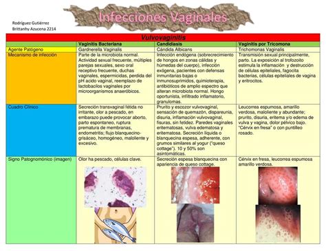 Top 142 Infecciones Vaginales Imagenes Smartindustrymx