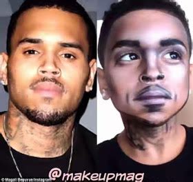 What has drake said about the surgery? OMG see what happens to Drake and Chris Brown face after ...
