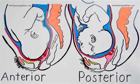 The Difference Between Anterior And Posterior Positions Baby Position