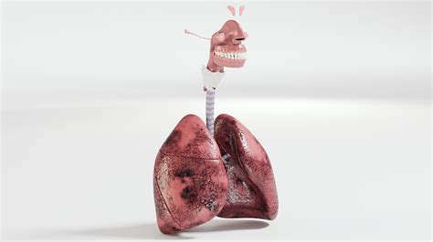 3d Respiratory Smoker S Lungs Model Turbosquid 1531699