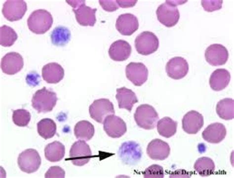 High platelet counts usually indicate a disorder of the bone marrow or an overwhelming. Cell identify - Veterinary Science Vets 205 with Howard at ...