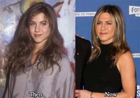 Jennifer Aniston Botox Before And After Photos Latest Plastic Surgery