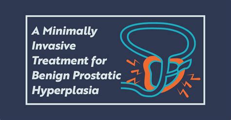 Prostate Artery Embolization A Minimally Invasive Treatment For Bph