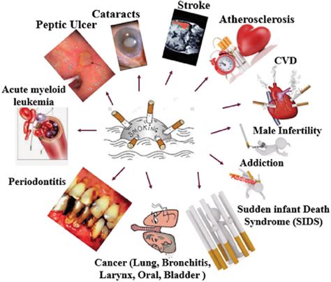 Smoking Effects On Human With A List Of Various Diseases Download Scientific Diagram