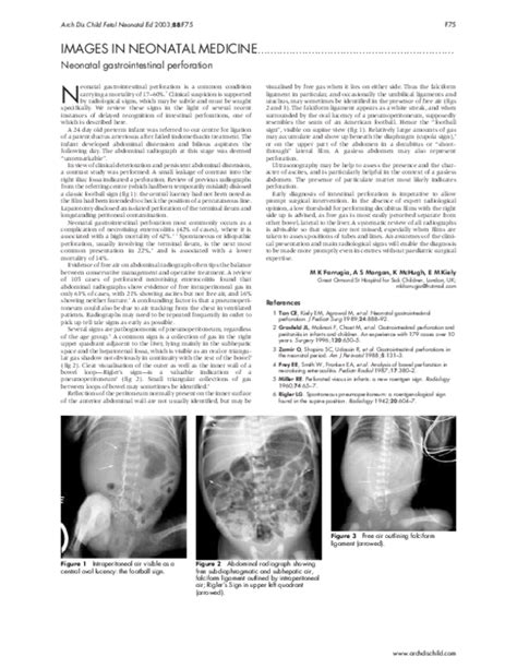 Pdf Neonatal Gastrointestinal Perforation Marie Klaire Farrugia