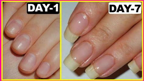 How To Grow Your Nails Faster In Just Week Nail Growth Remedy At Home Naturally YouTube